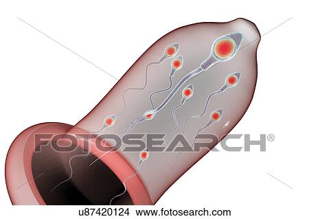 Picture - Contraception, conceptual illustration. Fotosearch