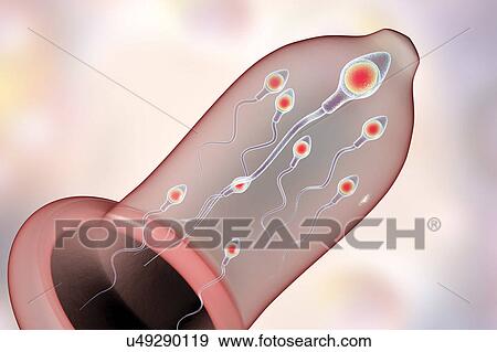 Stock Photo - Contraception, conceptual illustration. Fotosearch