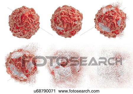 Stock Image - Destruction of a cancer cell, illustration. Fotosearch