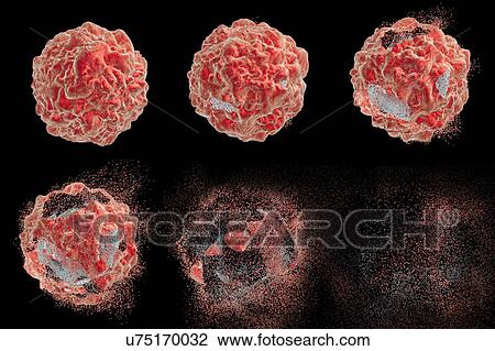 Destruction of a cancer cell, illustration View Large Photo Image Stock Image - Destruction of a cancer cell, illustration. Fotosearch