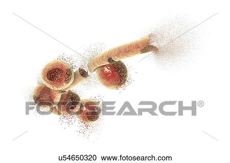 Destruction of Candida fungi, illustration View Large Photo Image Stock Image - Destruction of Candida fungi, illustration. Fotosearch