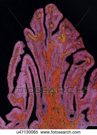 Fallopian tube, LM View Large Photo Image Stock Photography - Fallopian tube, LM. Fotosearch