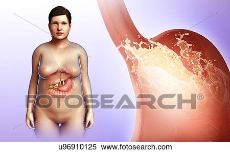 Female stomach acidity, illustration View Large Photo Image Stock Photography - Female stomach acidity, illustration. Fotosearch