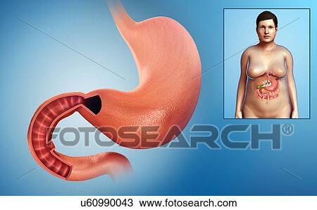 Stock Image - Female stomach and duodenum, illustration. Fotosearch