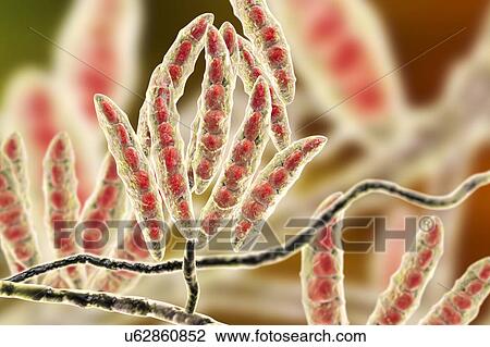 Fusarium fungus conidia, illustration View Large Photo Image Stock Image - Fusarium fungus conidia, illustration. Fotosearch