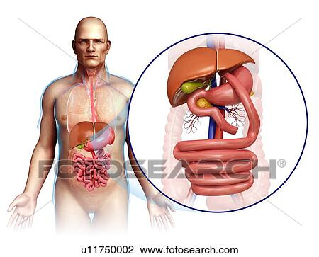 Stock Image - Gastric bypass, illustration. Fotosearch