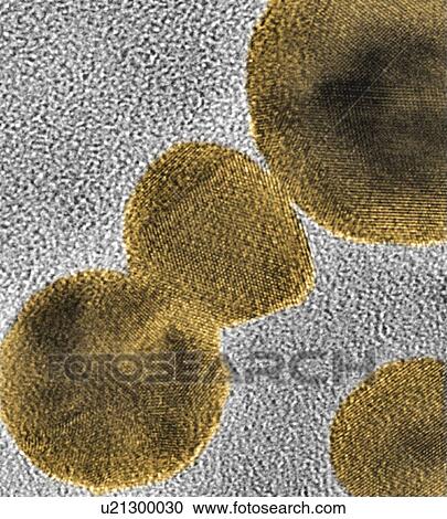 Stock Image - Gold nanoparticles, TEM. Fotosearch