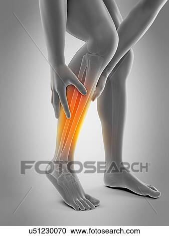 Stock Image - Human calf pain, illustration. Fotosearch