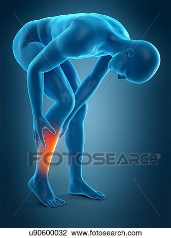 Stock Image - Human calf pain, illustration. Fotosearch