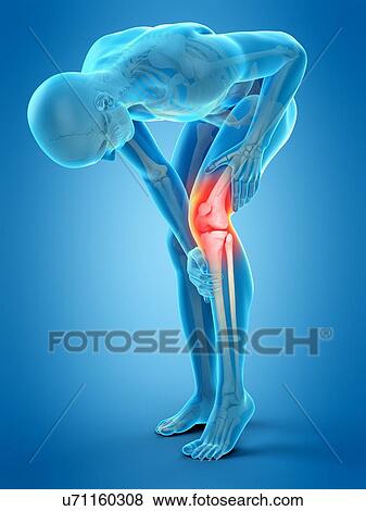 Human knee pain, illustration View Large Photo Image Stock Photo - Human knee pain, illustration. Fotosearch
