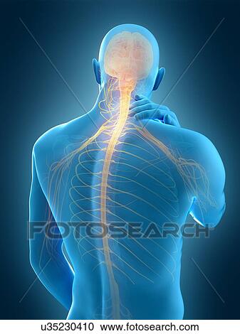 Stock Image - Human neck pain, illustration. Fotosearch