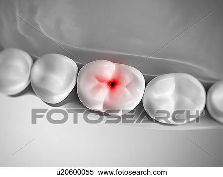 Stock Photography - Human tooth pain, illustration. Fotosearch