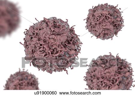 Stock Image - Lung cancer cell, illustration. Fotosearch