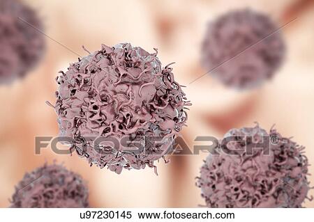 Stock Photography - Lung cancer cell, illustration. Fotosearch