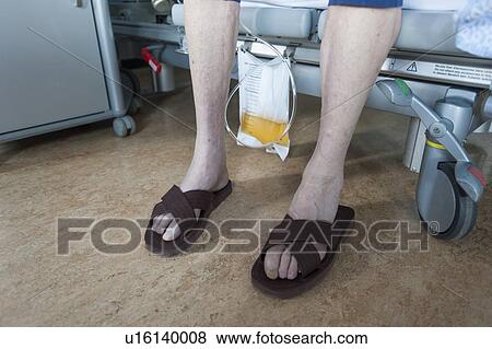 Stock Photo - Male patient wearing sandals with urostomy bag. Fotosearch