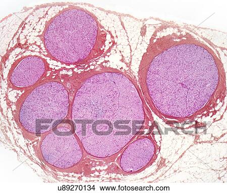 Picture - Nerve fibres, LM. Fotosearch