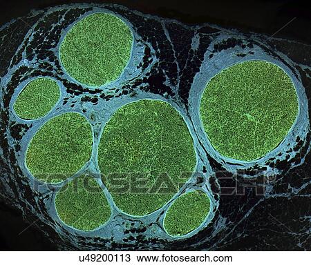 Stock Image - Nerve fibres, LM. Fotosearch