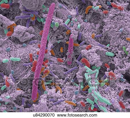 Stock Image - Oral bacteria, SEM. Fotosearch
