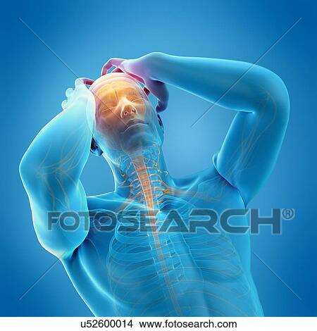 Picture - Person with headache, illustration. Fotosearch
