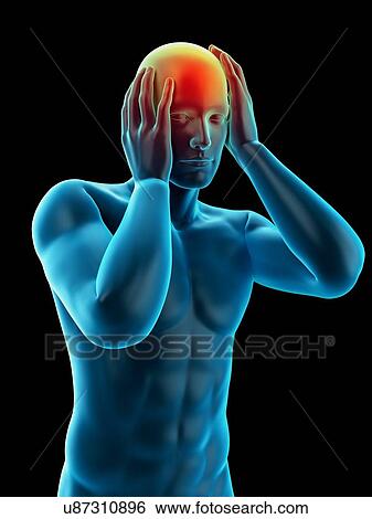 Stock Photograph - Person with headache, illustration. Fotosearch
