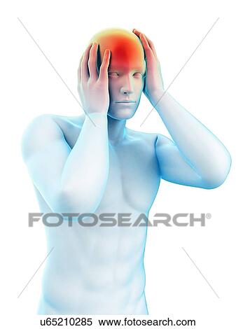 Person with headache, illustration View Large Photo Image Stock Photography - Person with headache, illustration. Fotosearch