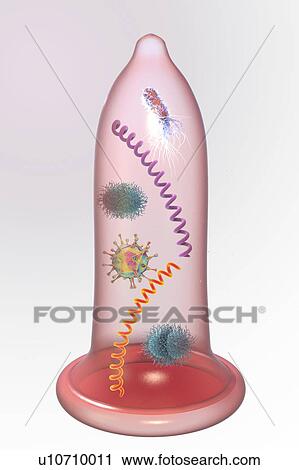 Stock Image - Prevention of sexually transmitted infections, conceptual il. Fotosearch