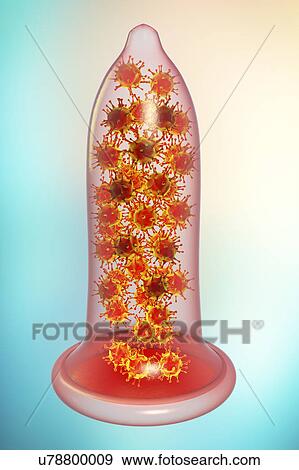 Prevention of sexually transmitted infections, conceptual il View Large Photo Image Stock Photo - Prevention of sexually transmitted infections, conceptual il. Fotosearch