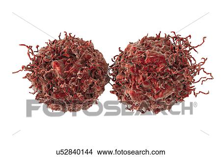 Prostate cancer cells, illustration View Large Photo Image Picture - Prostate cancer cells, illustration. Fotosearch