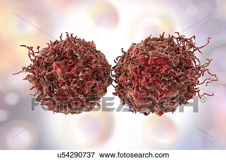 Stock Photo - Prostate cancer cells, illustration. Fotosearch