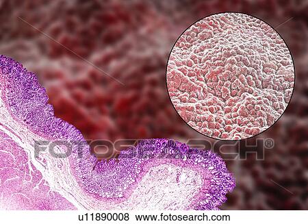 Stomach mucosa, light micrograph and illustration View Large Photo Image Stock Photo - Stomach mucosa, light micrograph and illustration. Fotosearch