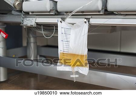 Stock Image - Urostomy bag on hospital bed. Fotosearch