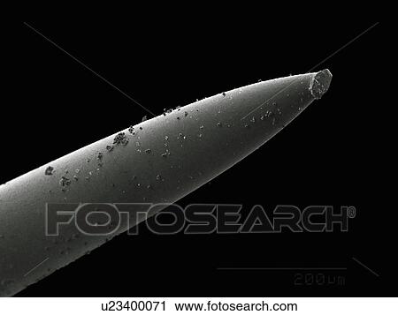 Acupuncture needle View Large Photo Image Stock Image - Acupuncture needle. Fotosearch