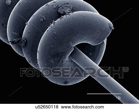 Stock Photo - Acupuncture needle. Fotosearch