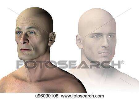 Stock Photo - Aging, illustration. Fotosearch