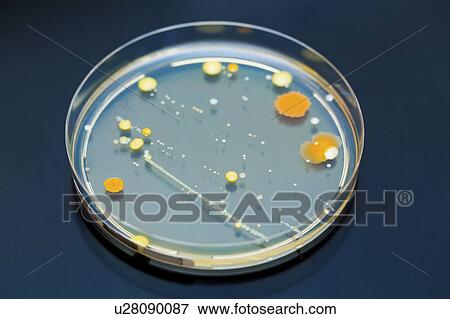 Stock Photo - Bacteria in a petri dish. Fotosearch