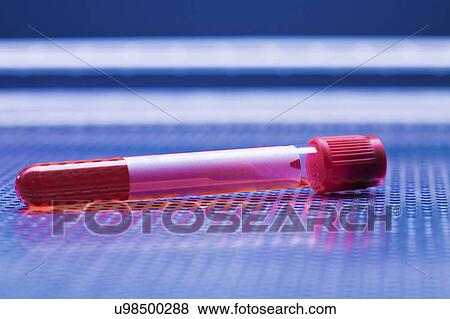 Stock Photo - Blood sample in a virology tube. Fotosearch