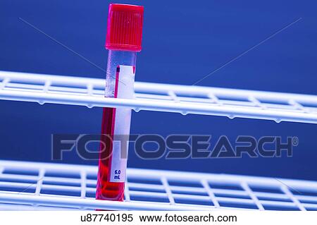 Blood sample in a virology tube View Large Photo Image Stock Photography - Blood sample in a virology tube. Fotosearch