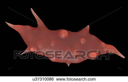 Bone cancer cell View Large Photo Image Stock Photograph - Bone cancer cell. Fotosearch