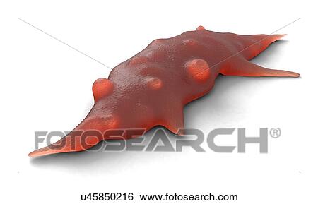 Stock Photograph - Bone cancer cell. Fotosearch