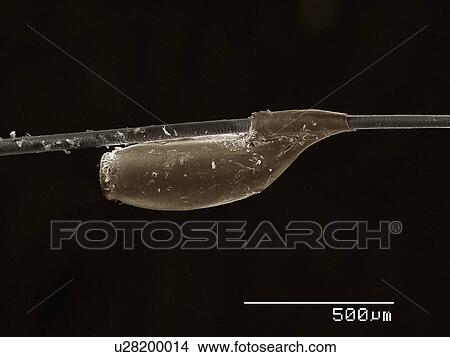 Egg of cat louse (Phthiraptera: Trichodectidae, Felicola Subrostratus) on the hair of host View Large Photo Image Picture - Egg of cat louse (Phthiraptera: Trichodectidae, Felicola Subrostratus) on the hair of host. Fotosearch