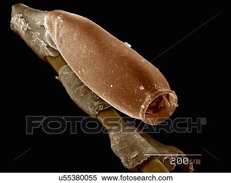 Stock Photography - Egg of cat louse (Phthiraptera: Trichodectidae, Felicola Subrostratus) on the hair of host. Fotosearch