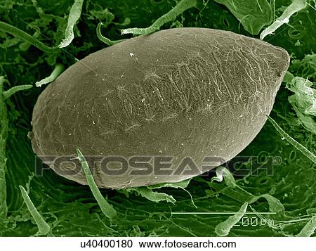 Stock Image - Egg of Psocid (Cerobasis sp. ) on leaf surface. Fotosearch
