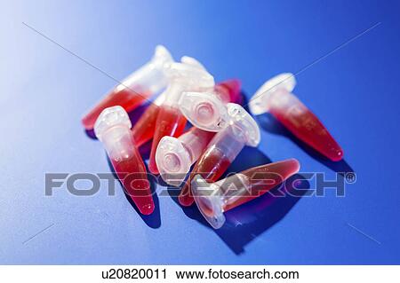 Stock Image - Eppendorf tubes containing blood samples. Fotosearch