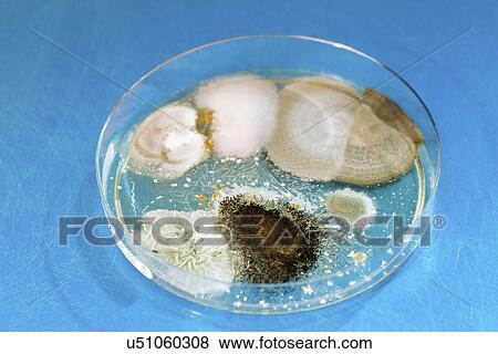 Mould and bacteria on petri dish View Large Photo Image Stock Photo - Mould and bacteria on petri dish. Fotosearch