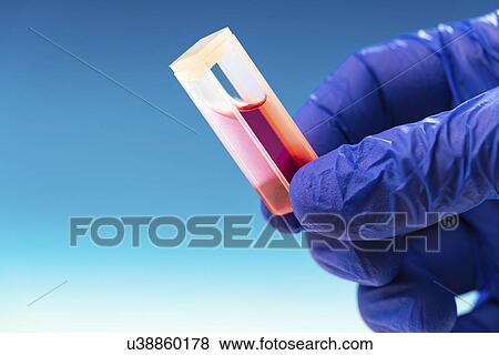 Person holding a cuvette containing a sample View Large Photo Image Stock Photo - Person holding a cuvette containing a sample. Fotosearch