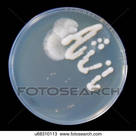 Stock Image - Petri dish with fungi. Fotosearch