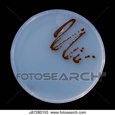 Stock Image - Petri dish with fungi. Fotosearch