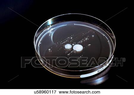 Stock Photo - Petri dish with fungi. Fotosearch