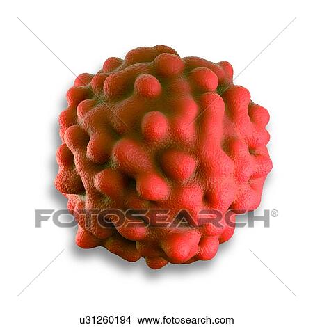 Rectal cancer cell View Large Photo Image Picture - Rectal cancer cell. Fotosearch