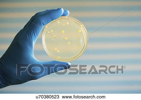 Scientist holding petri dish with bacteria View Large Photo Image Stock Image - Scientist holding petri dish with bacteria. Fotosearch